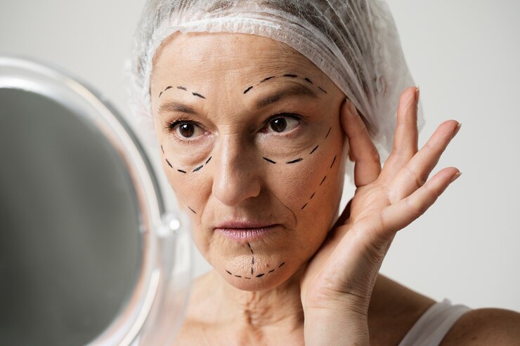Anti Aging Market Share