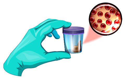 Fecal Occult Testing Market 1