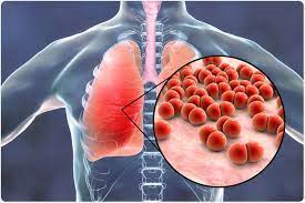 Pneumonia Market