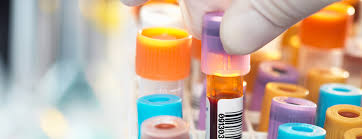 Uric Acid 1