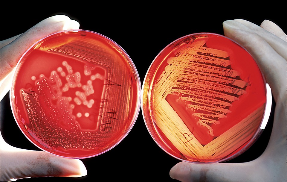 blood culture test market