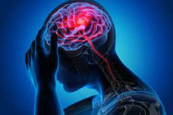 Brain Hemorrhage Market 2