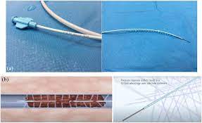 Catheter-Directed Thrombolysis Devices Market