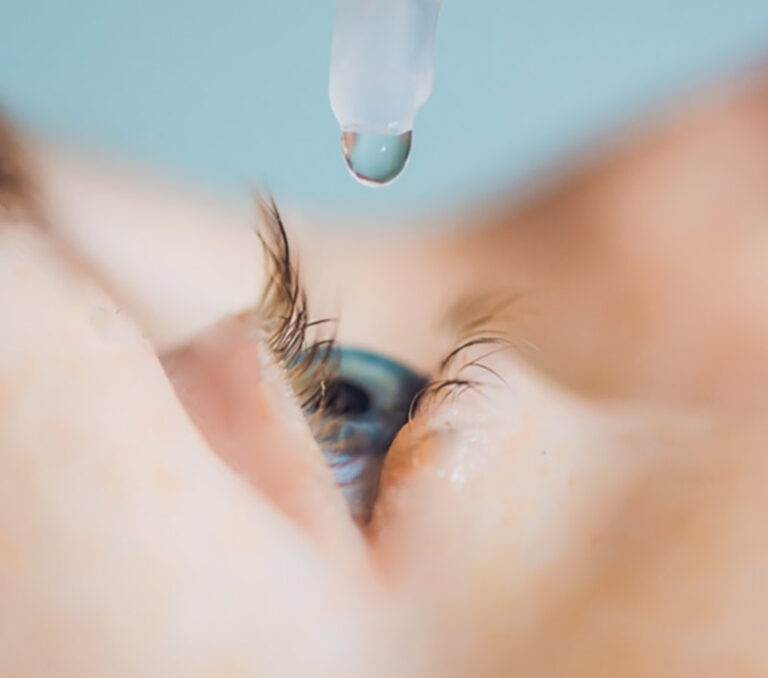 Japan Dry Eye Syndrome Market