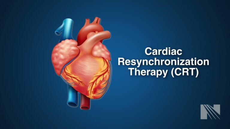 Cardiac Resynchronization Therapy (CRT)