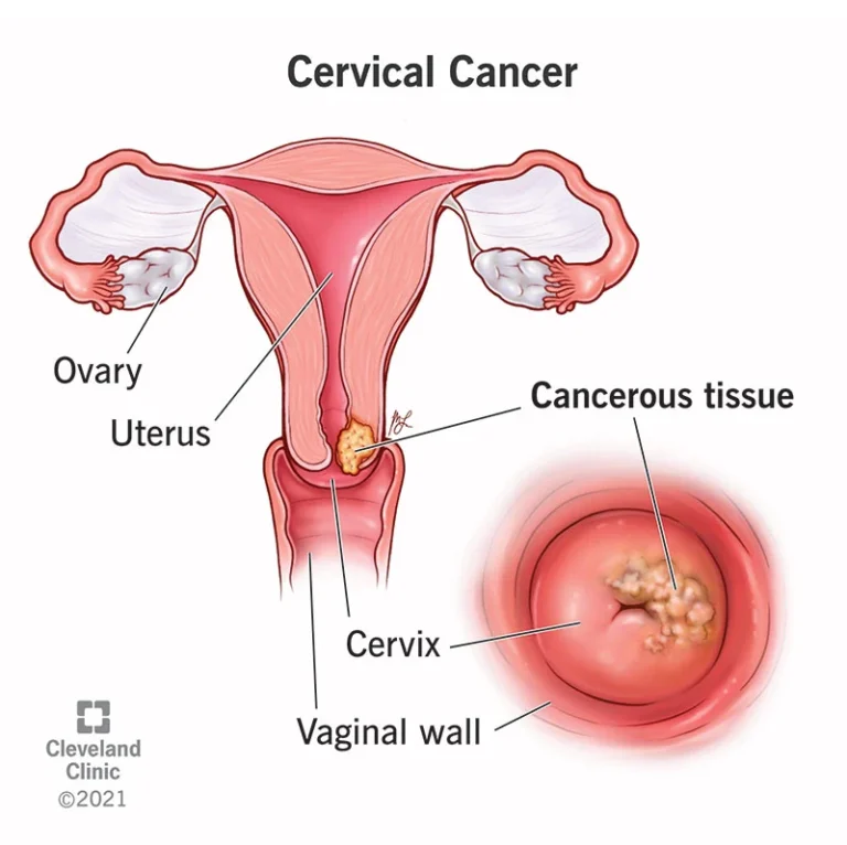 Cervical Cancer Diagnostics Market