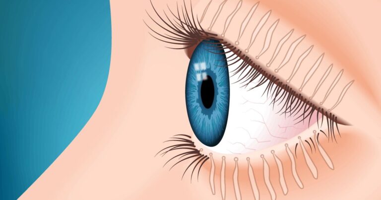 meibomian gland dysfunction market
