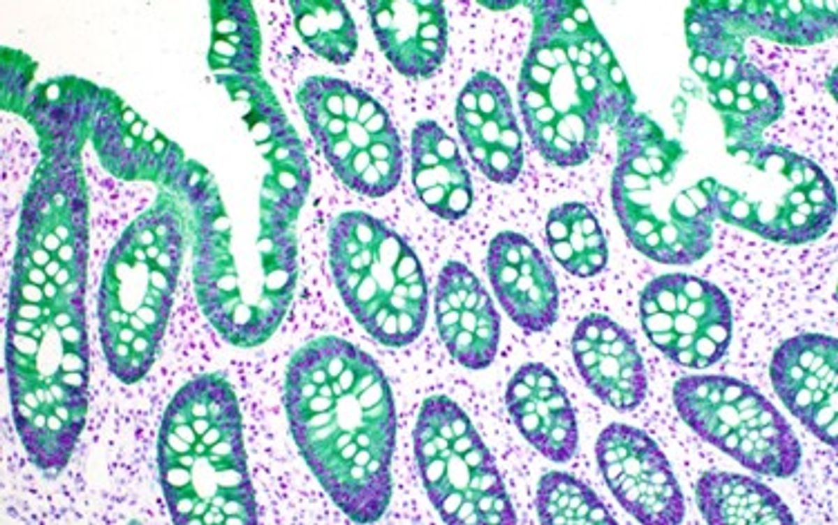 Immunohistochemistry