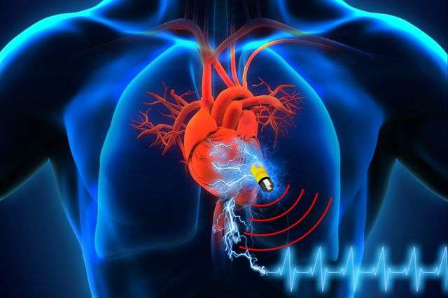 Implantable Medical Devices Market