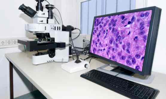Japan Digital Pathology Market