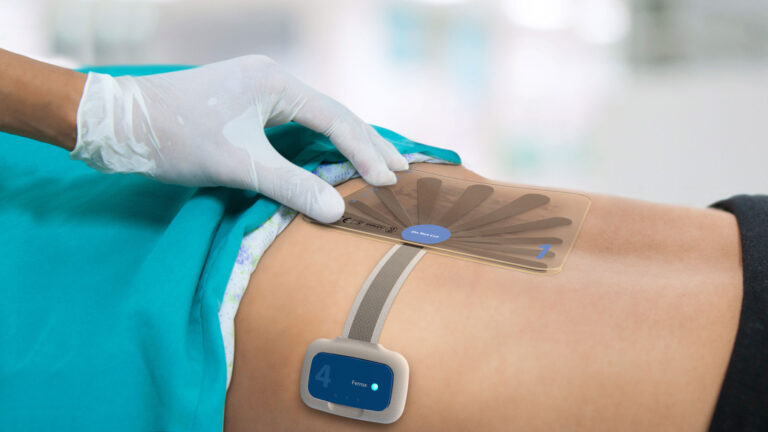 Japan Wound Care Management Devices Market