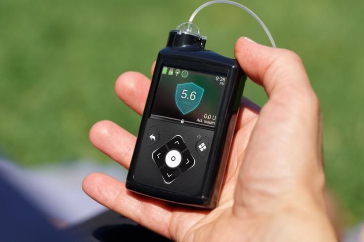 Japan Insulin Infusion Pump Market