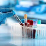 Japan In Vitro Diagnostics (IVD) Market