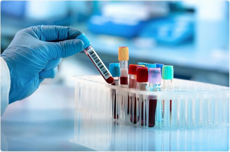 Japan In Vitro Diagnostics (IVD) Market